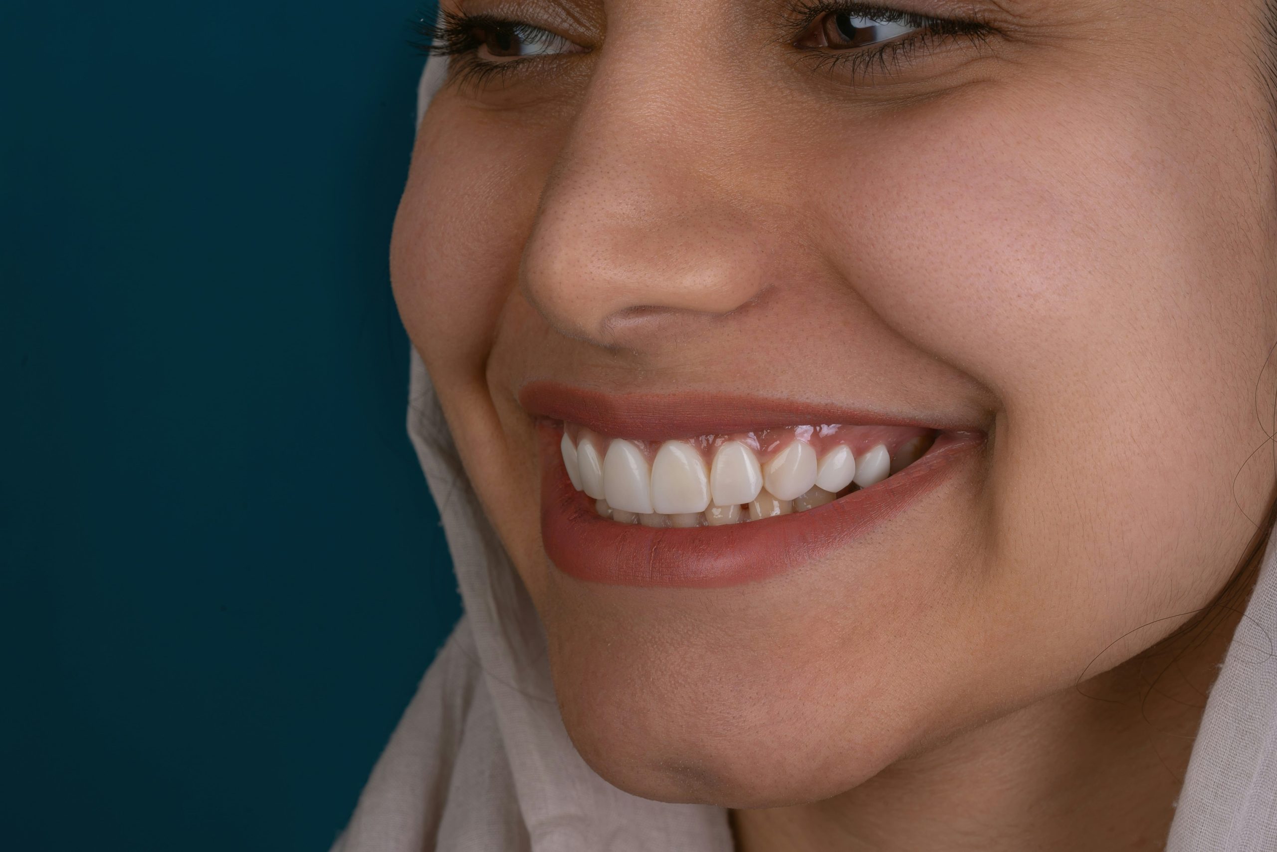 ¿Cuándo hacer blanqueamiento dental en casa?