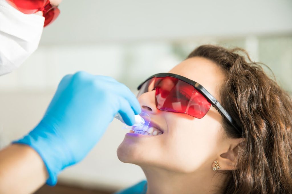 En qué consiste el blanqueamiento dental