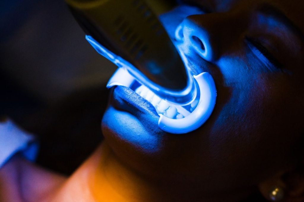 ¿Es verdad que el blanqueamiento dental duele?