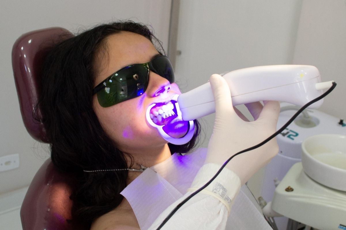 ¿Duele un blanqueamiento dental? Esto debes hacer para evitarlo