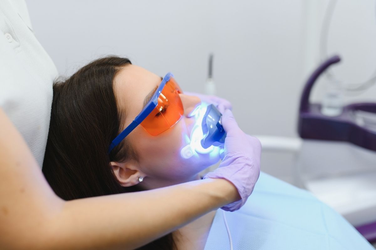 Precio del Blanqueamiento Dental en Madrid