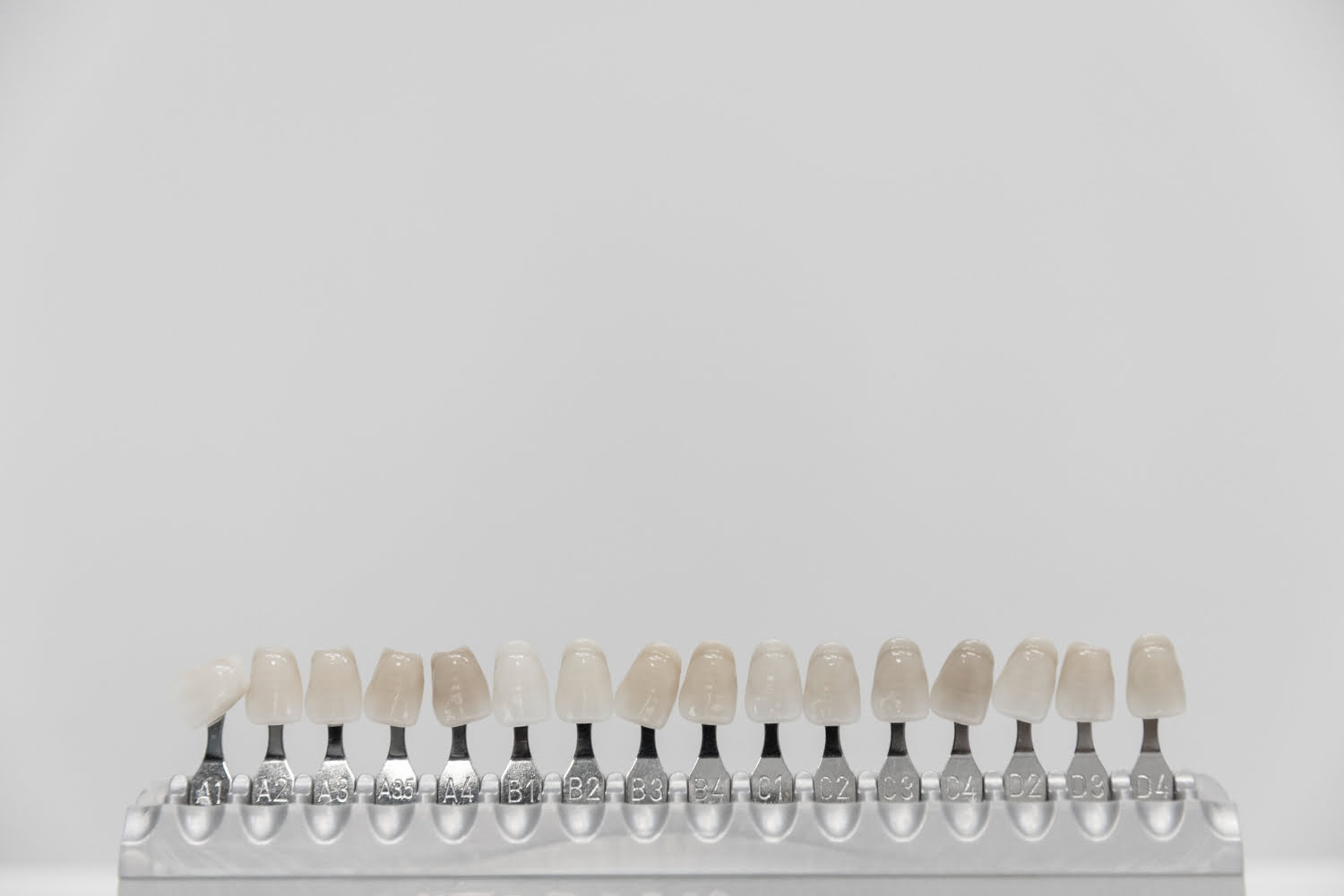 Las mejores carillas dentales: Tipos y cómo elegir la ideal