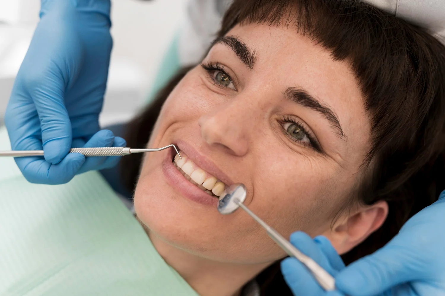 Microcarillas dentales: Sonrisa perfecta sin limar tus dientes