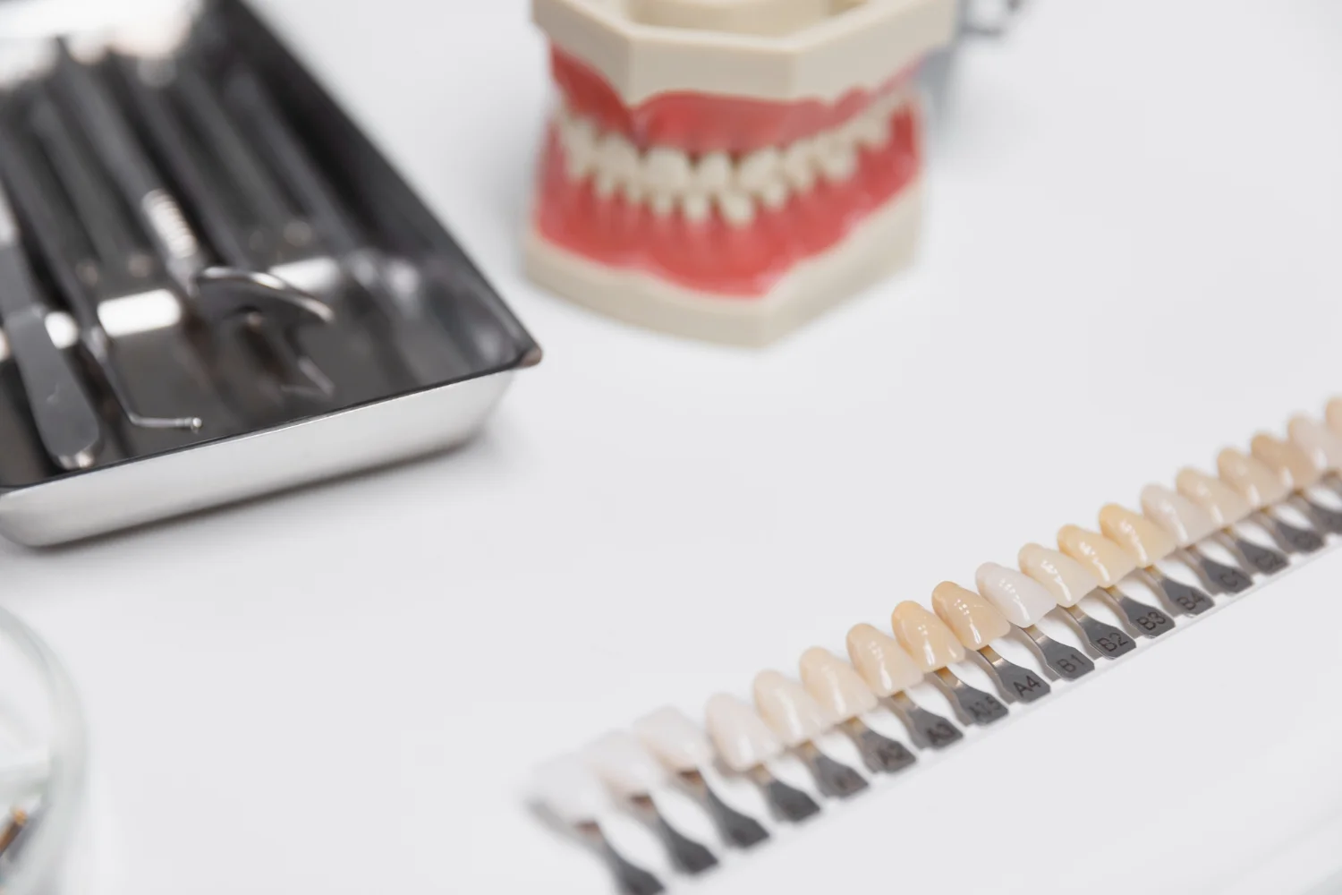 Tipos de carillas dentales: Encuentra la opción ideal para tu sonrisa